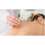 acupuntura para dor nas costas Brás