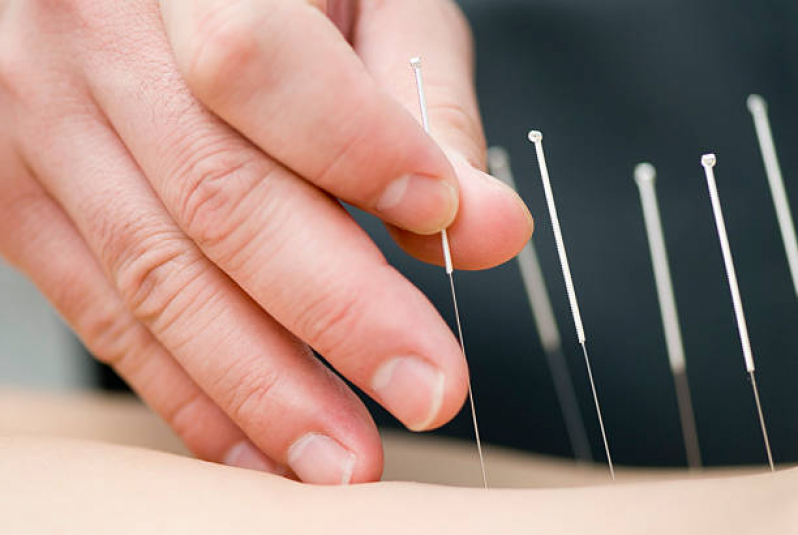 acupuntura-no-joelho